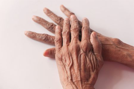 Parkinson Gak Cuma Soal Gemetar Tapi Juga Mental! Ini Penjelasannya